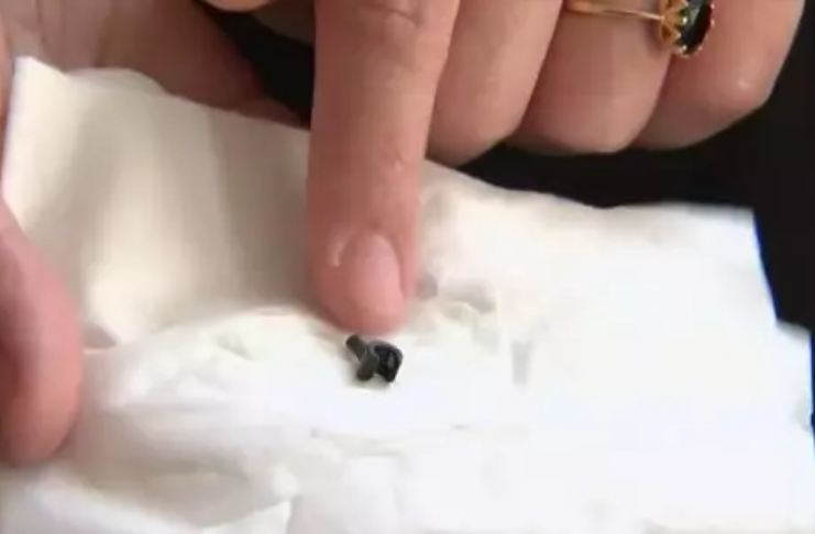 Criança encontra peça de lego que está entalada no nariz há dois anos